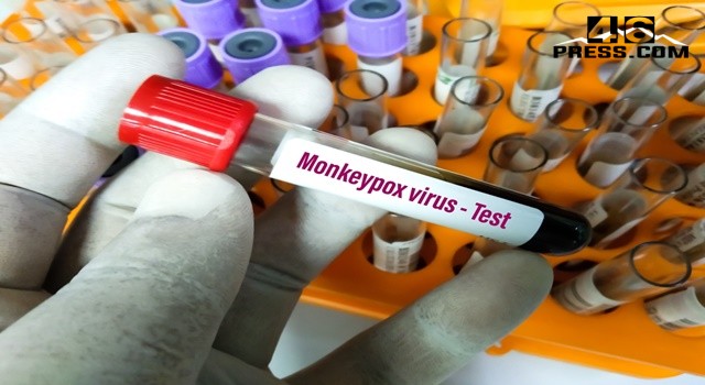 Maymun Çiçeği Virüsü Hakkında Bilinmesi Gereken 5 Nokta